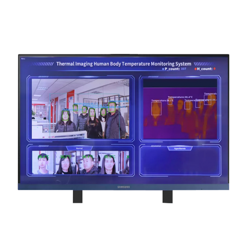 Thermal Imaging Human Body Temperature | Thermal Scanner Camera